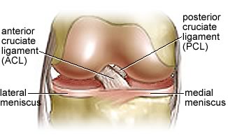 seif_acl20pcl20closeup.jpg
